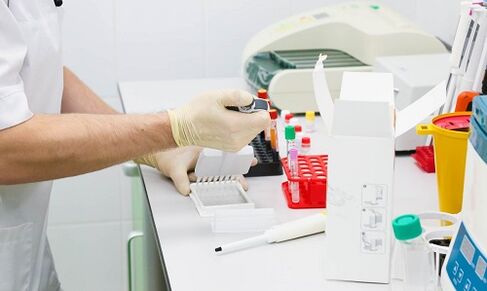 krvné testy na podkožné parazity