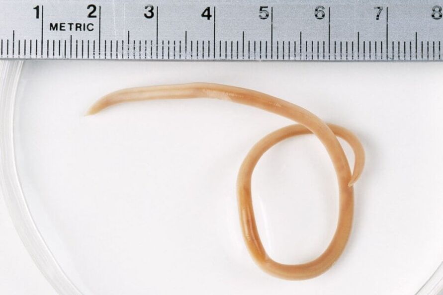 pinworm z ľudského tela