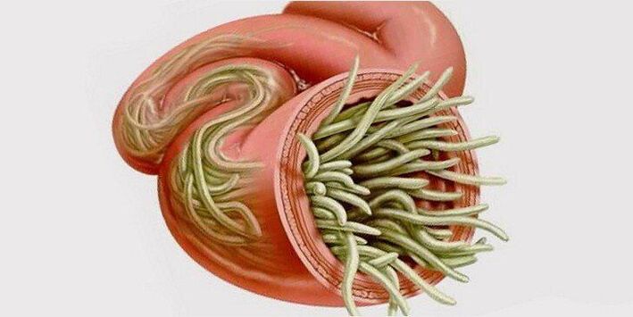 červy v črevách