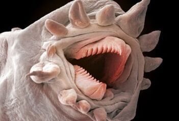 aké červy môžu žiť v ľudskom tele