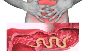 príznaky prítomnosti parazitov v ľudskom čreve