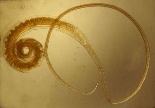 Trichinella červ z ľudského tela